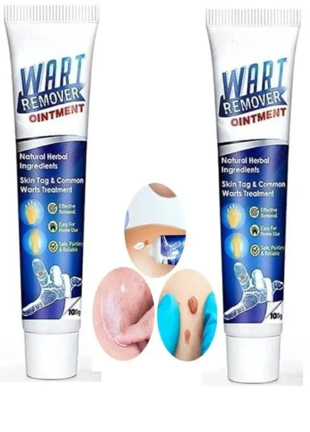 Wart remover painless solution