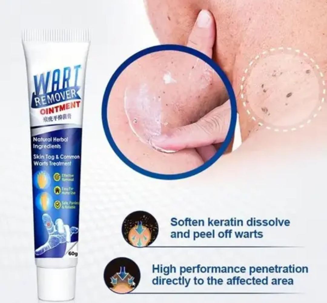 Wart remover painless solution