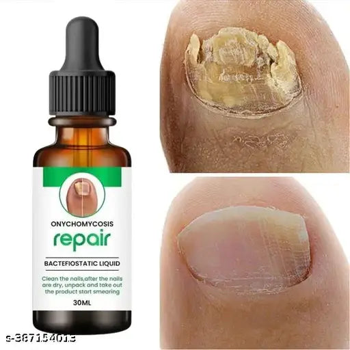 Nail Oil - For Nail Growth