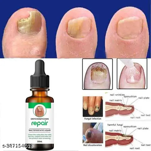 Nail Oil - For Nail Growth |Long,Strong Nail |Repair Break Nail & Cuticle Yellow